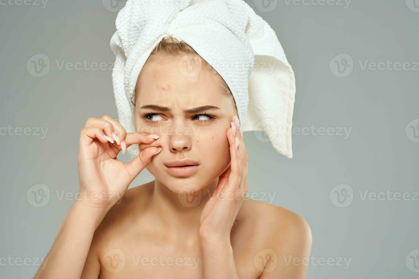 pretty woman with bare shoulders squeeze pimples on her face skin problems photo