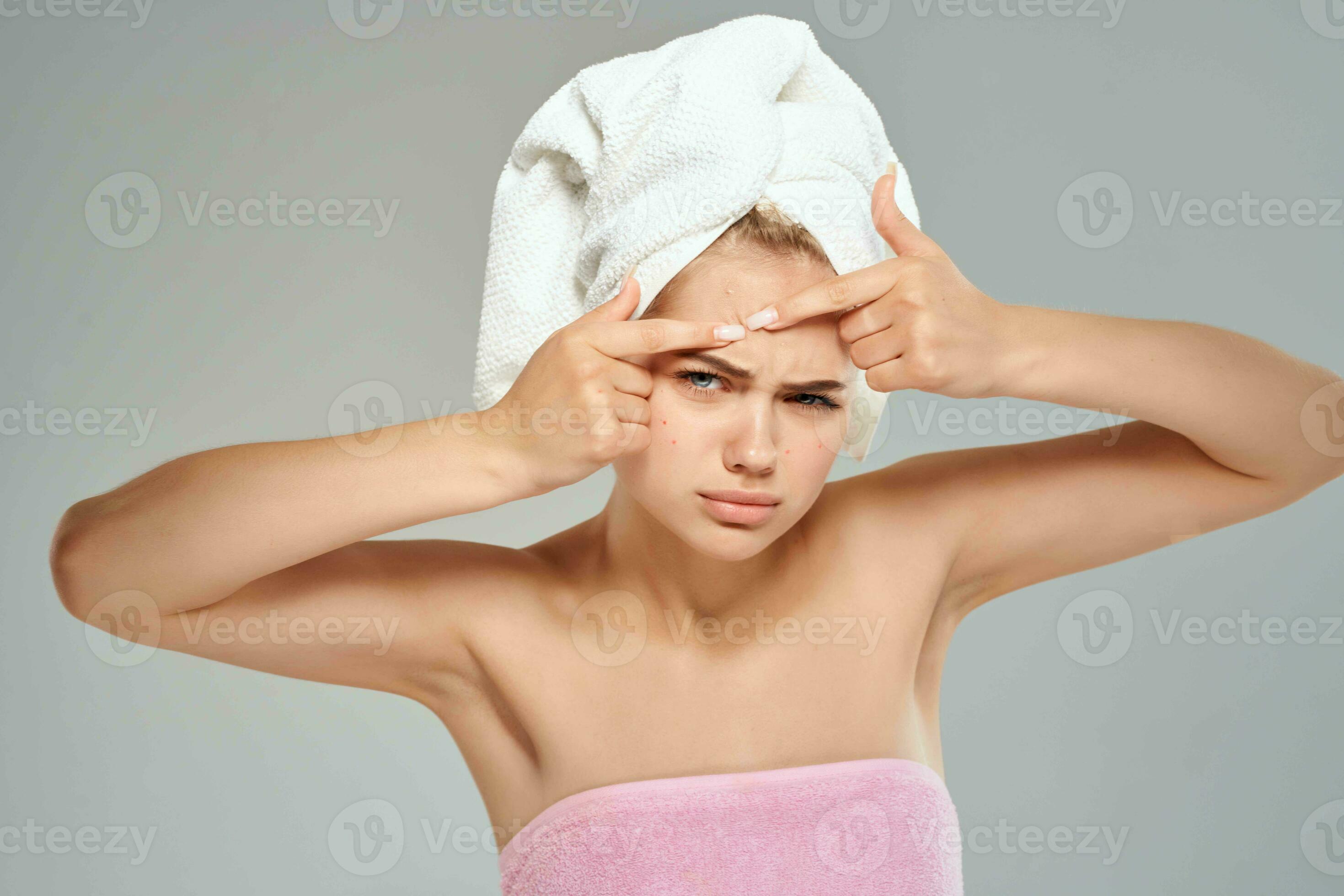 woman with bare shoulders squeeze pimples on her face towel on her head