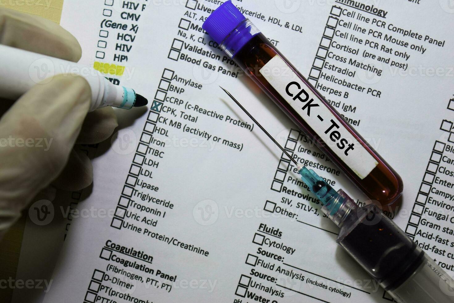 CPK Test with blood sample. Top view isolated on office desk. Healthcare Medical concept