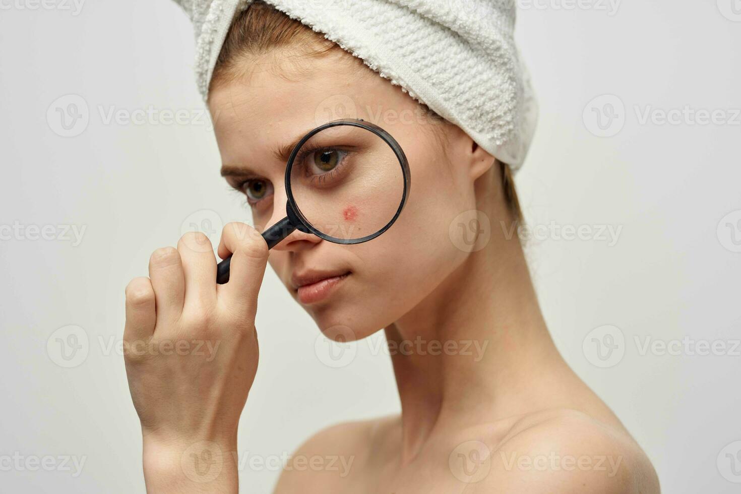 beautiful woman with a pimple on the face hygiene treatment photo