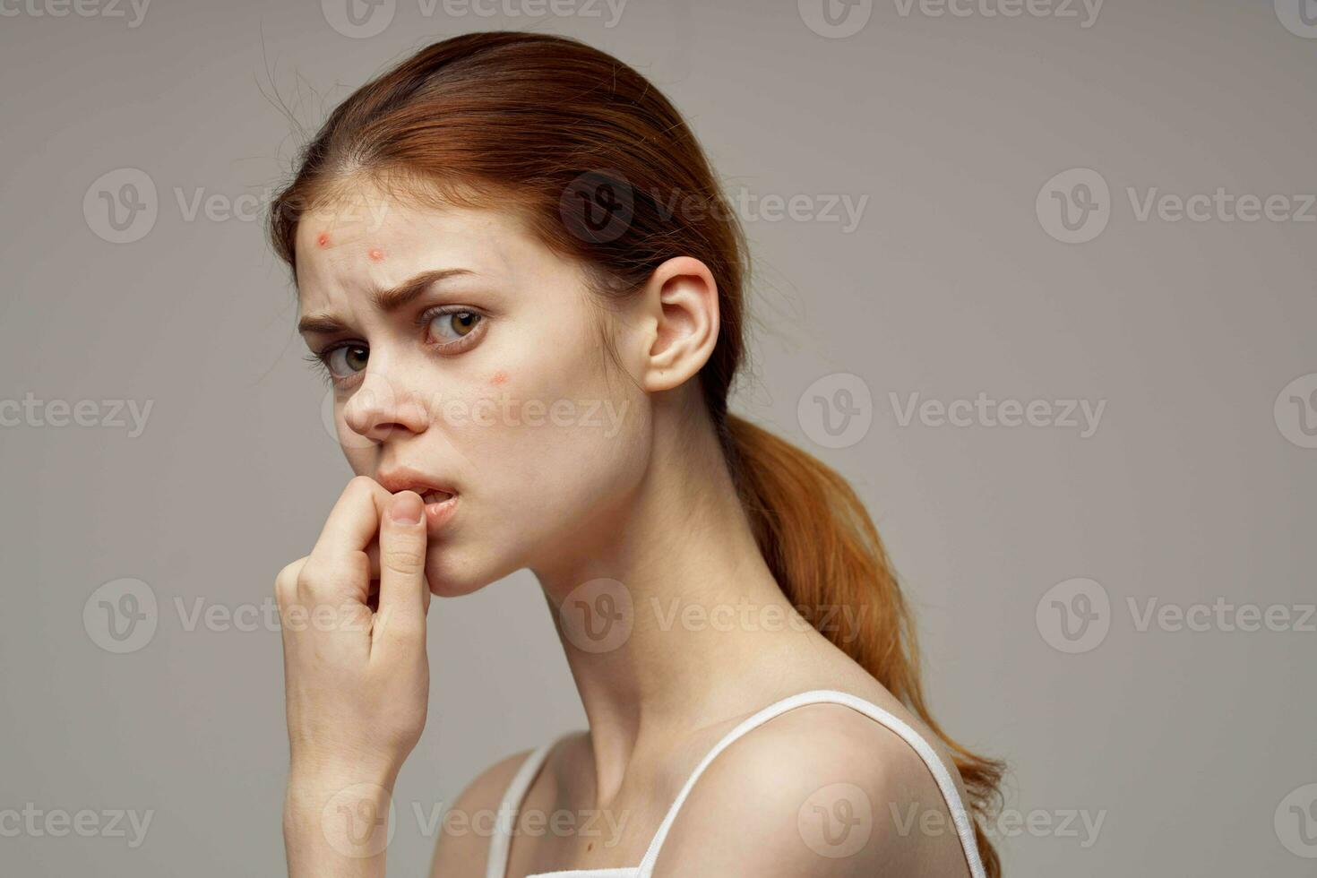 beautiful woman in a white t-shirt pimples on the face close-up photo