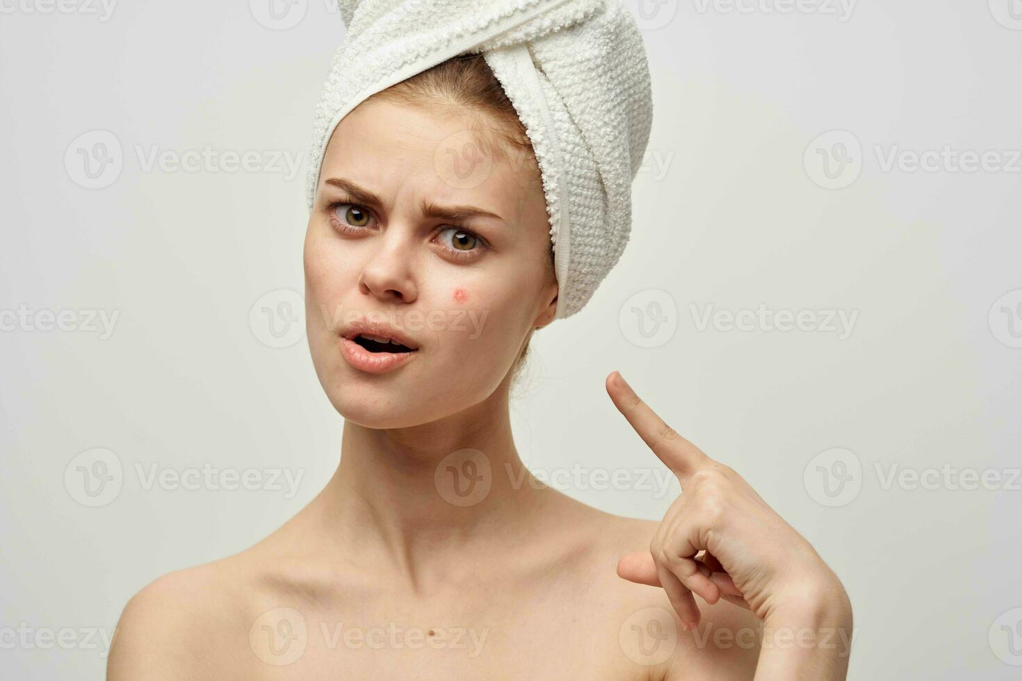 beautiful woman with a pimple on the face dermatology isolated background photo