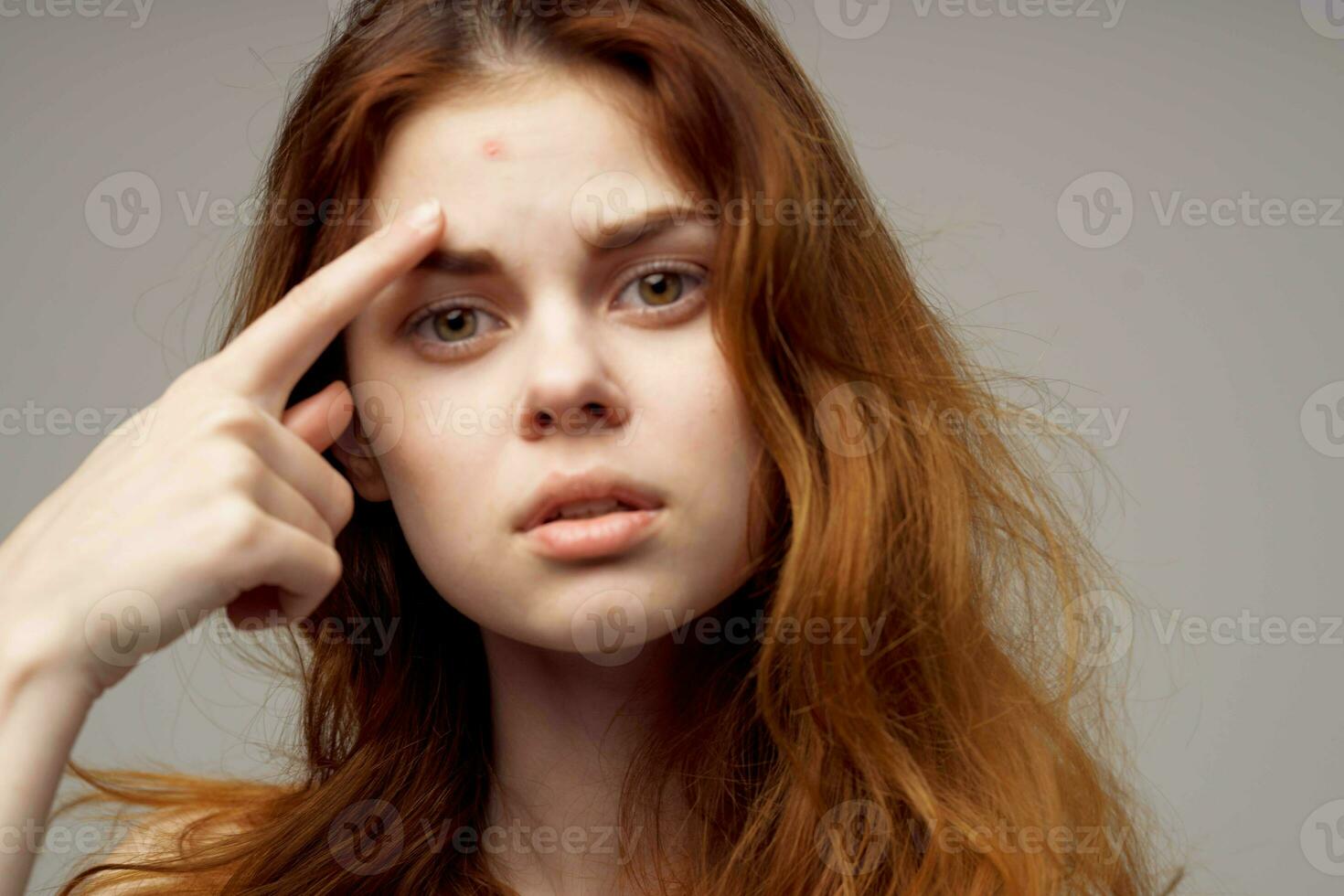 pretty woman facial skin problems dermatology close-up photo