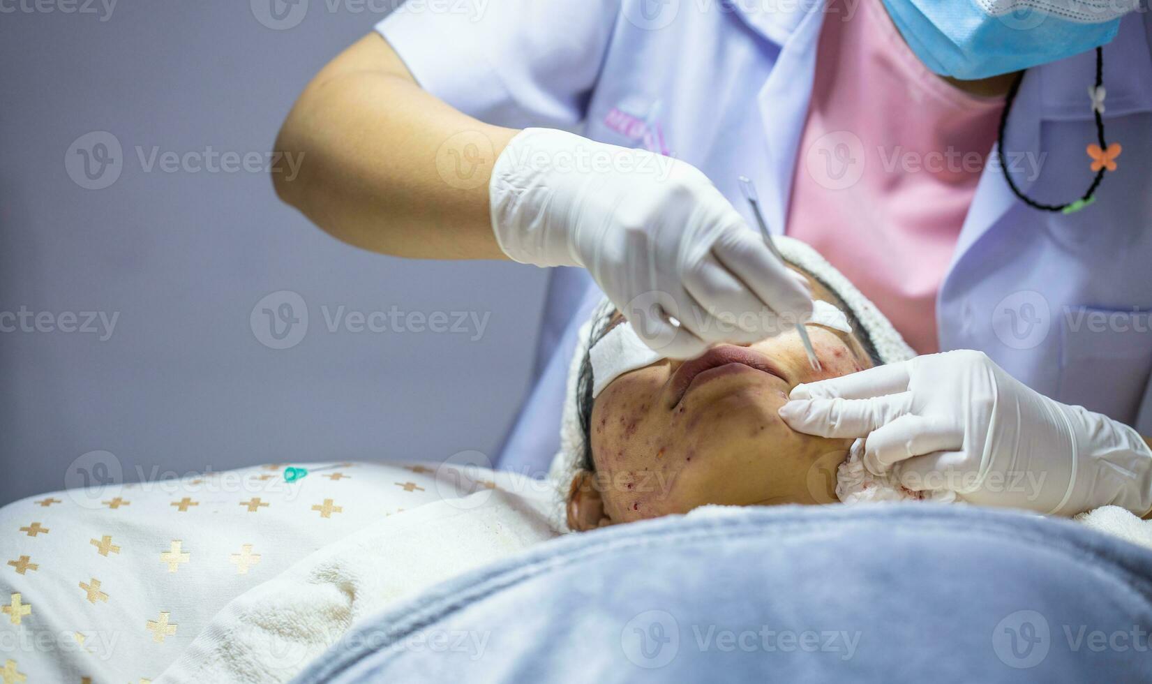 Acne extraction in a beauty clinic. Skin inflammation. The concept of beauty in women. Skin disorders lead to depression and insecurity in women. photo