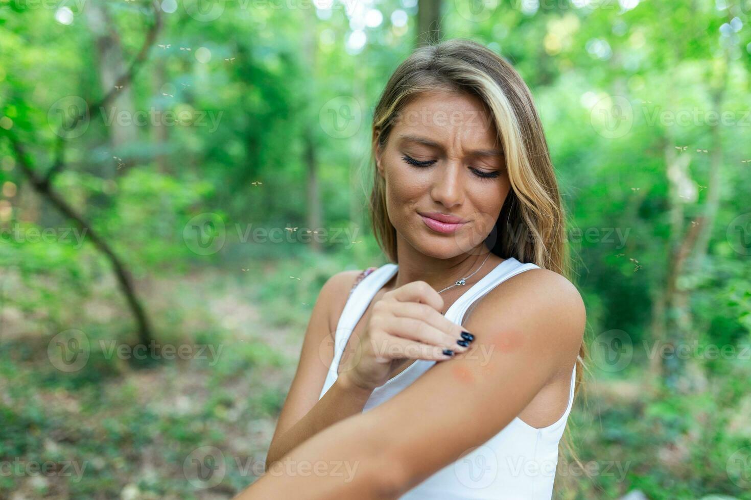 Itchy insect bite - Irritated young female scratching her itching arm from a mosquito bite at the park during summertime. photo