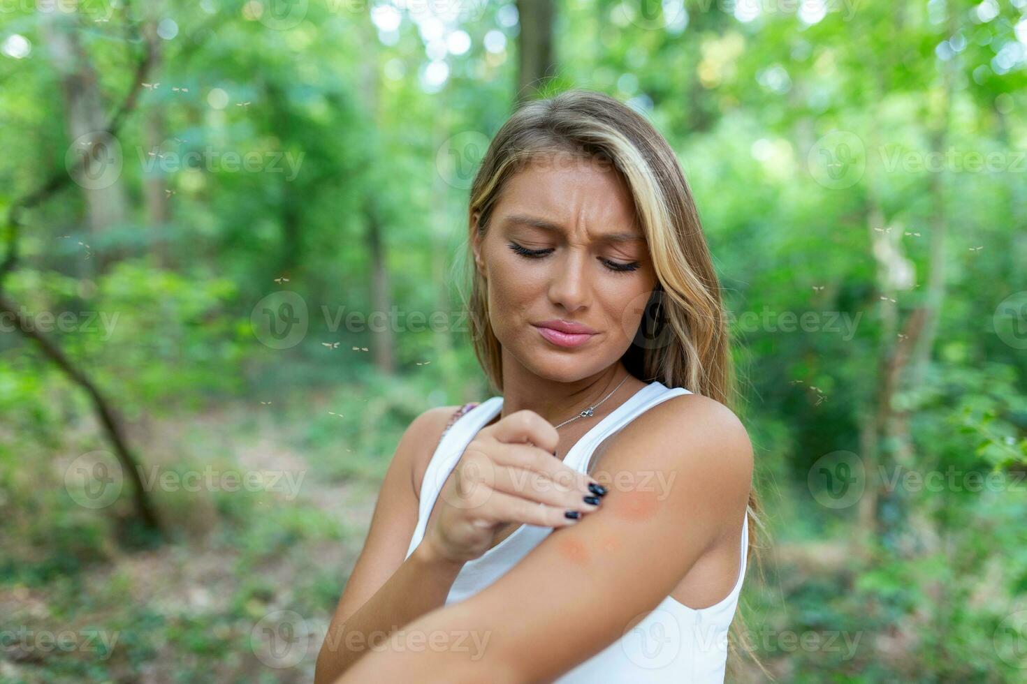 Itchy insect bite - Irritated young female scratching her itching arm from a mosquito bite at the park during summertime. photo
