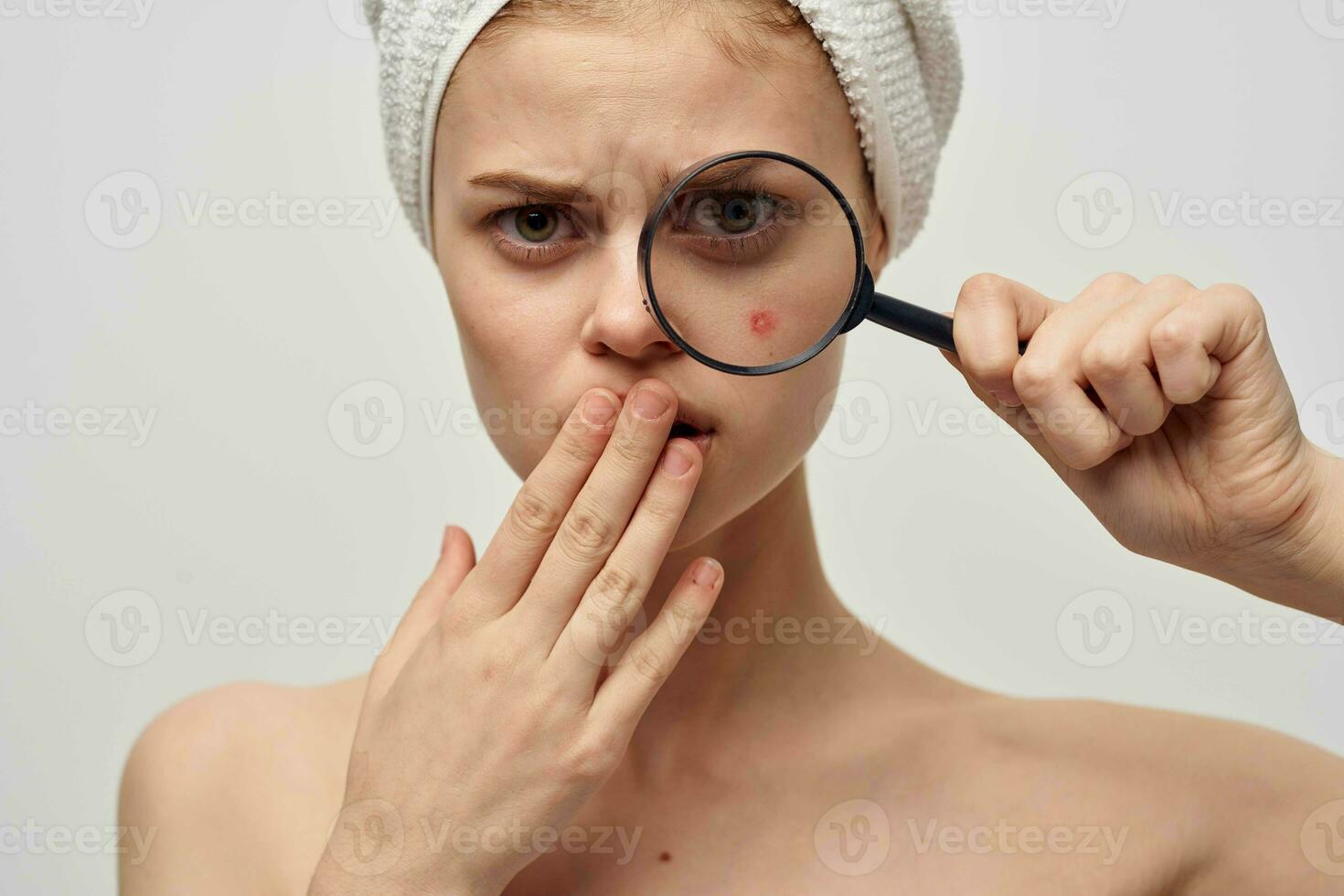 woman with a pimple on the face dermatology isolated background photo
