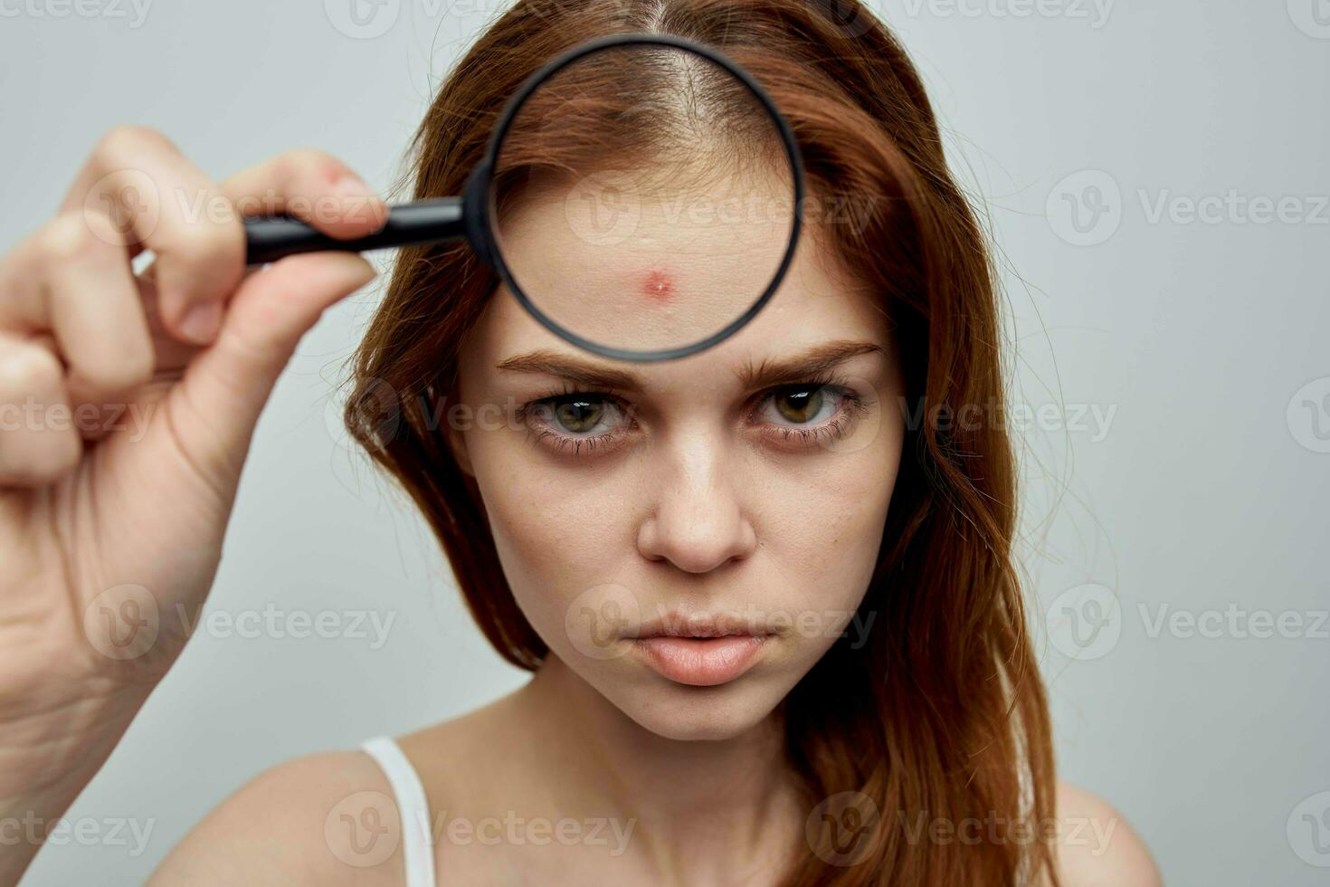 woman with a pimple on the face cosmetology Studio photo