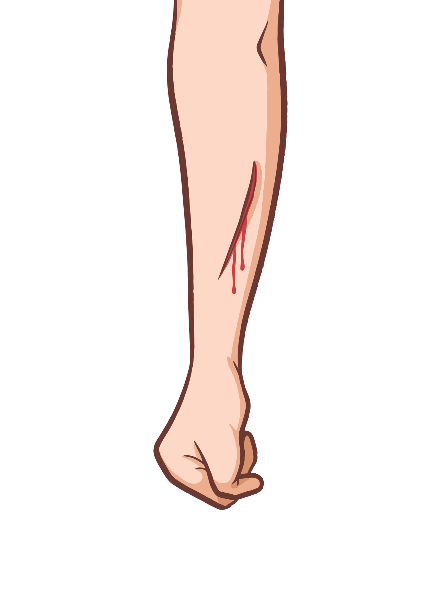 Bleeding scar or wound on arm hand skin vector illustration isolated on