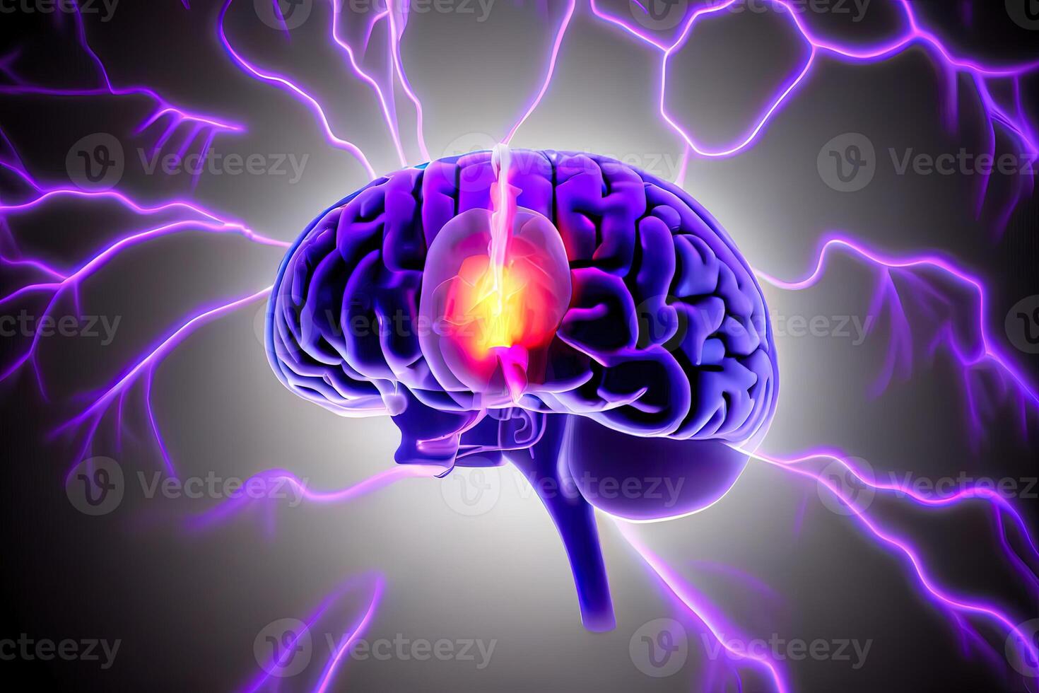 Brain disease technology template. photo