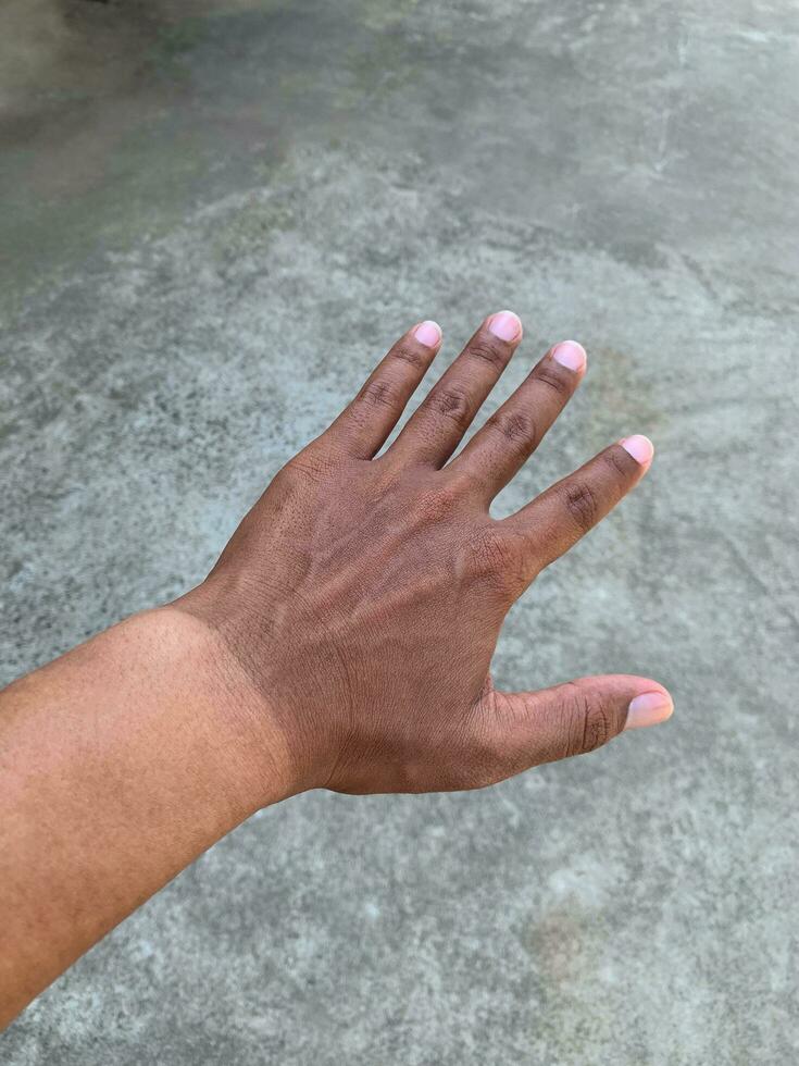 Man's hands are darkened from working outdoors without protection from the daytime sun.Skin exposed to sunlight on a regular basis can cause melanoma. photo