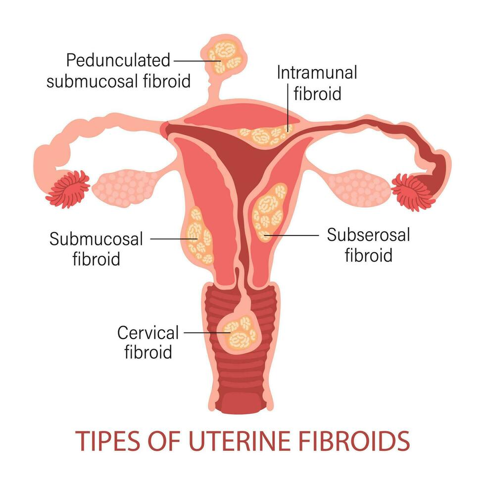 Diagram of the Uterus