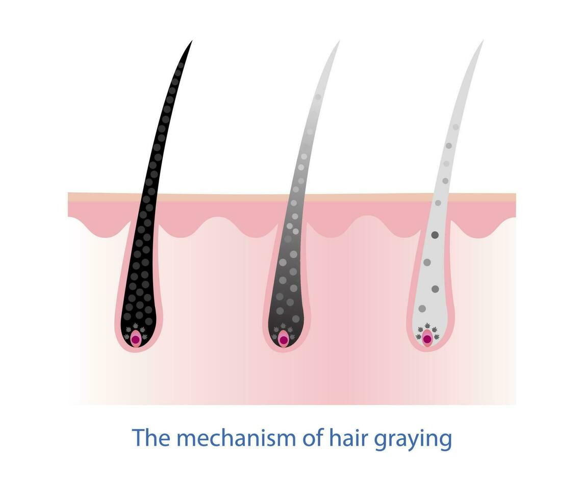The mechanism of hair graying with scalp layer vector isolated on white background. Hair anatomy, hair structure, hair care concept illustration.