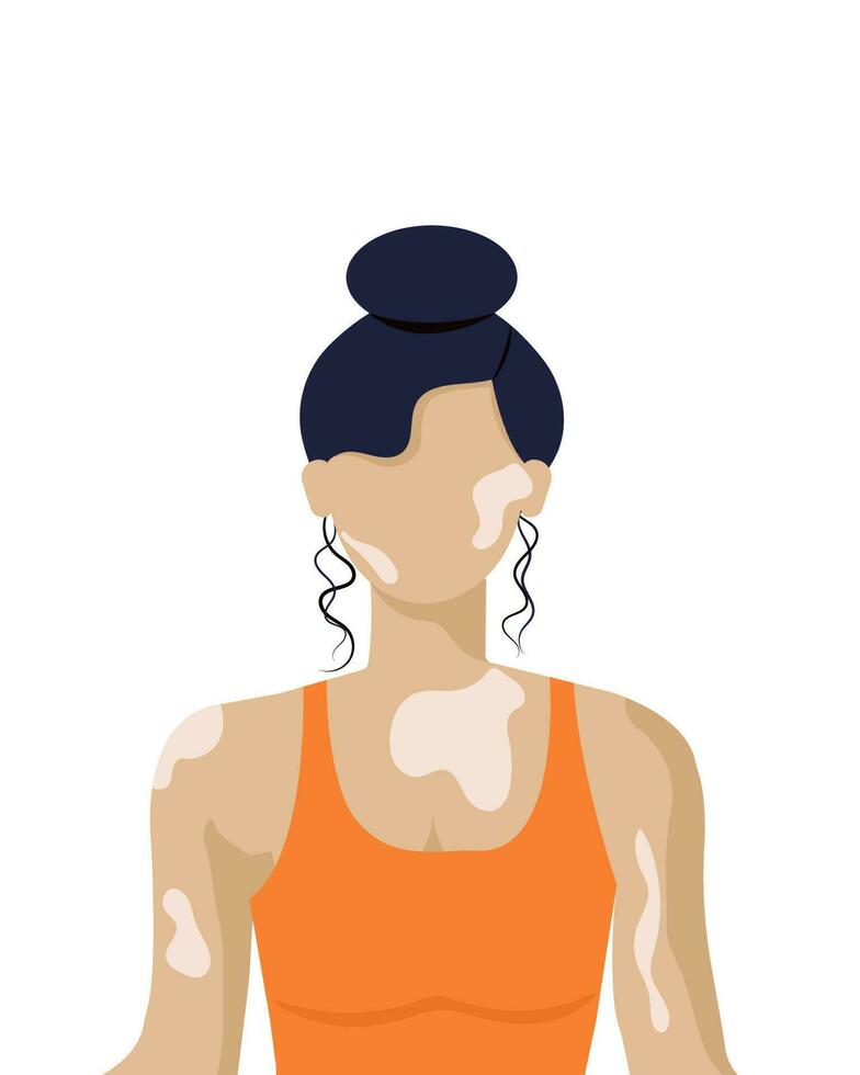 de piel clara sin rostro niña con vitiligo en blanco antecedentes. vector ilustración. belleza de un diferente amable. cuerpo positivo.