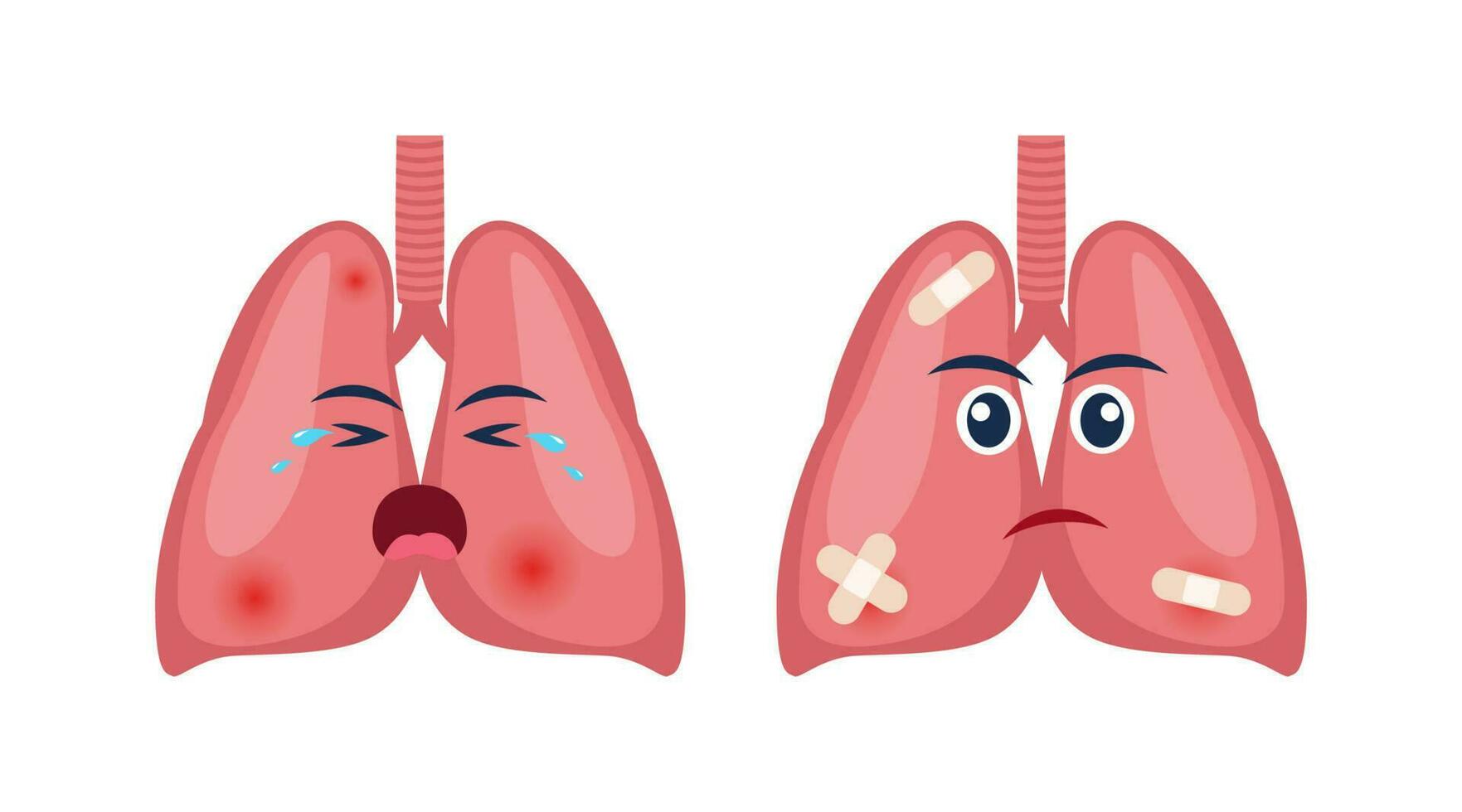 enfermo livianos con dolor dolor o enfermedad. triste dibujos animados personaje pulmones, cuerpo Organo lesionado o insalubre. humano dibujos animados anatomía, niños medicamento. vector ilustración.