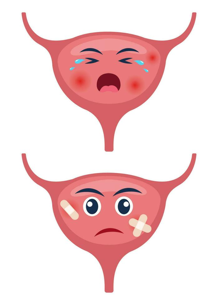 enfermo vejiga con dolor dolor o enfermedad. triste dibujos animados personaje vejiga, cuerpo Organo lesionado o insalubre. humano dibujos animados anatomía, niños medicamento. vector ilustración.