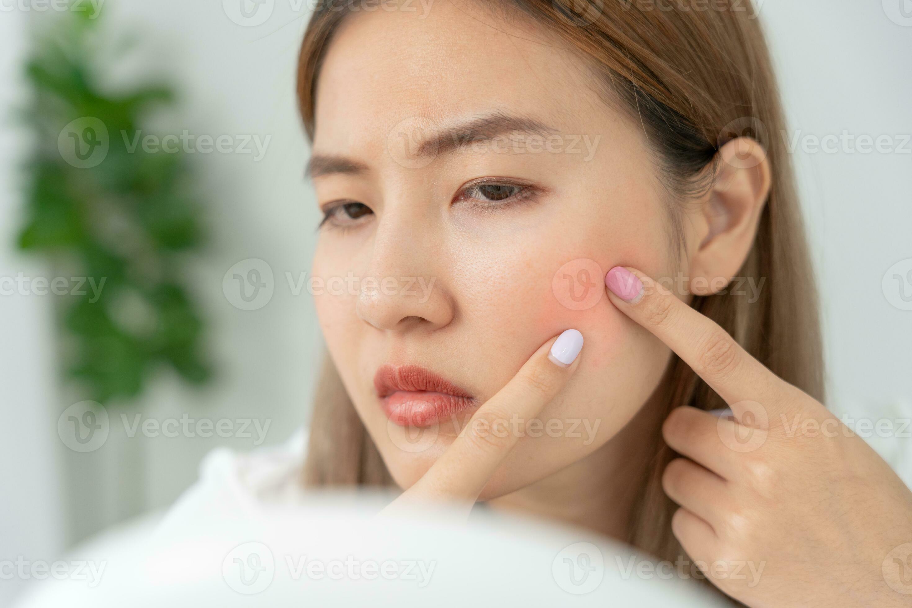Young woman asian are worried about faces Dermatology and allergic to