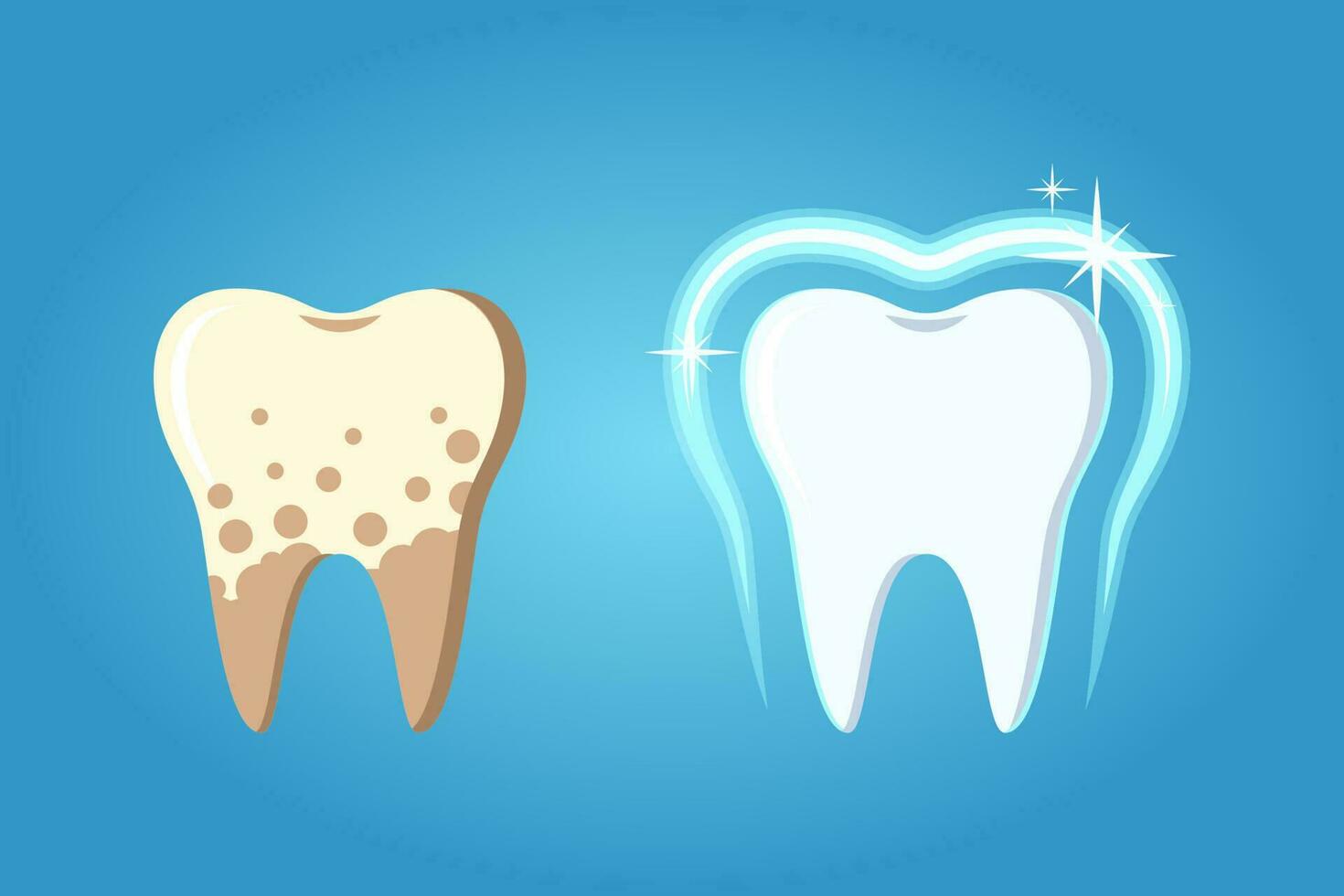 Difference between treated teeth and teeth with plaque vector