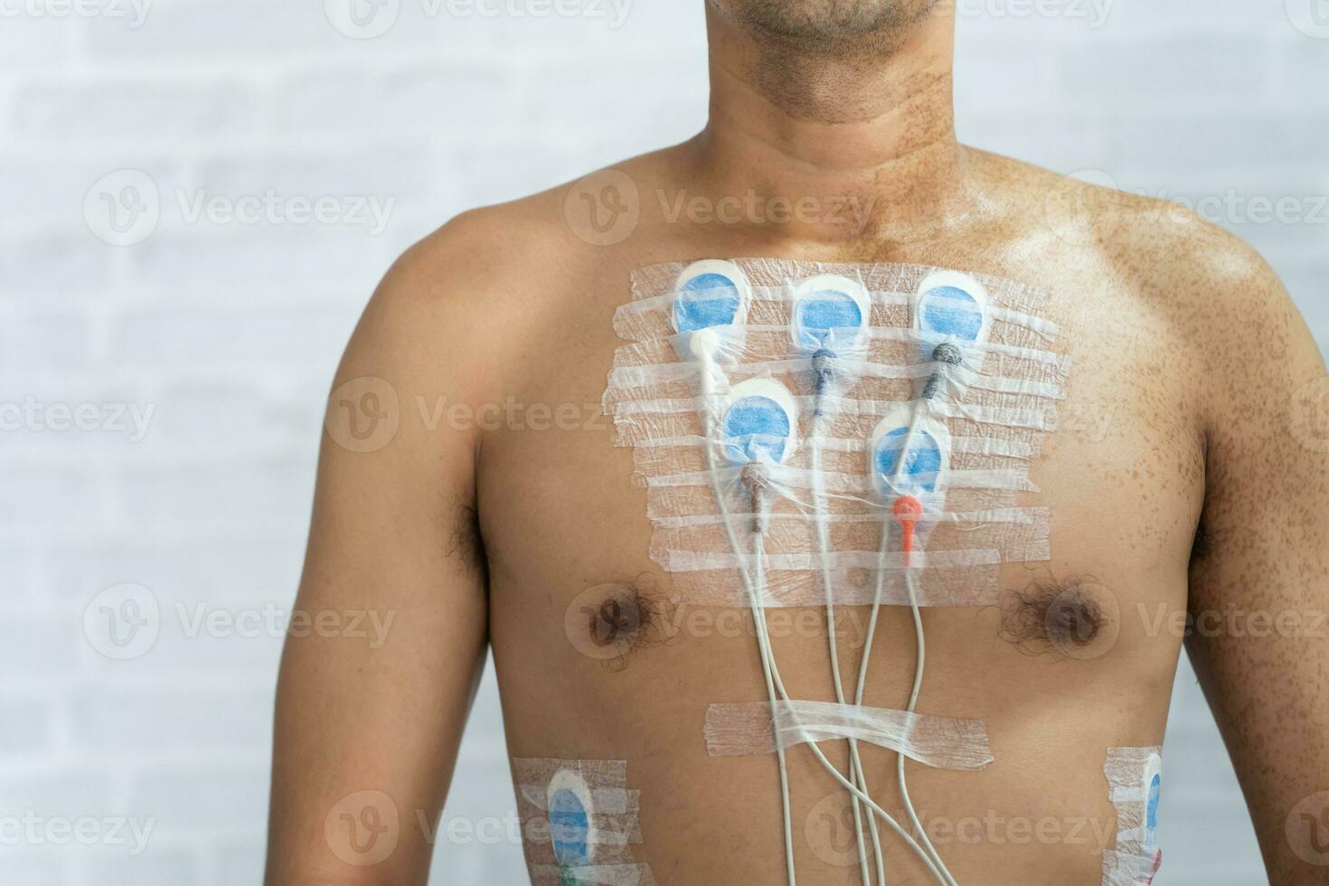 Man wearing 24 hrs electrocardiogram monitor device on his chest, Electrodes rhythm Holter monitoring and blood pressure monitor system on the chest of a man. Health care heart disease concept. photo