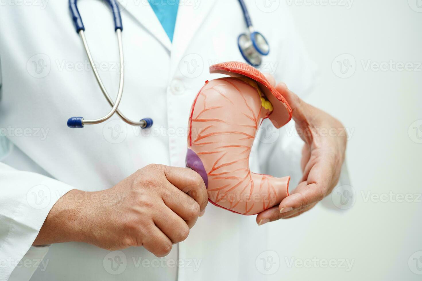 Stomach disease, doctor holding anatomy model for study diagnosis and treatment in hospital. photo