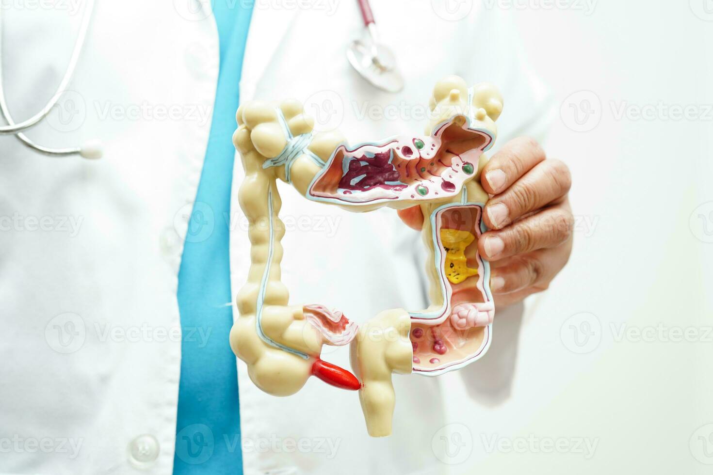 intestino, médico participación anatomía modelo para estudiar diagnóstico y tratamiento en hospital. foto