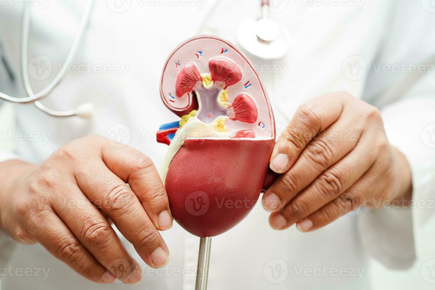 Chronic kidney disease, doctor holding model for treatment urinary system, urology, Estimated glomerular filtration rate eGFR. photo