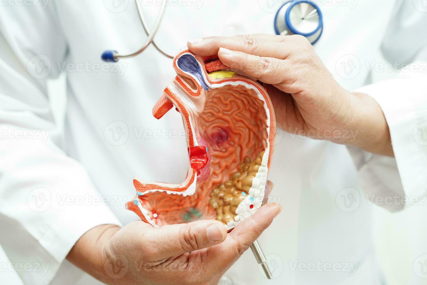 Stomach disease, doctor holding anatomy model for study diagnosis and treatment in hospital. photo