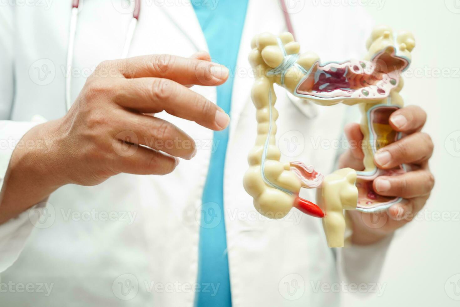 Intestine, doctor holding anatomy model for study diagnosis and treatment in hospital. photo