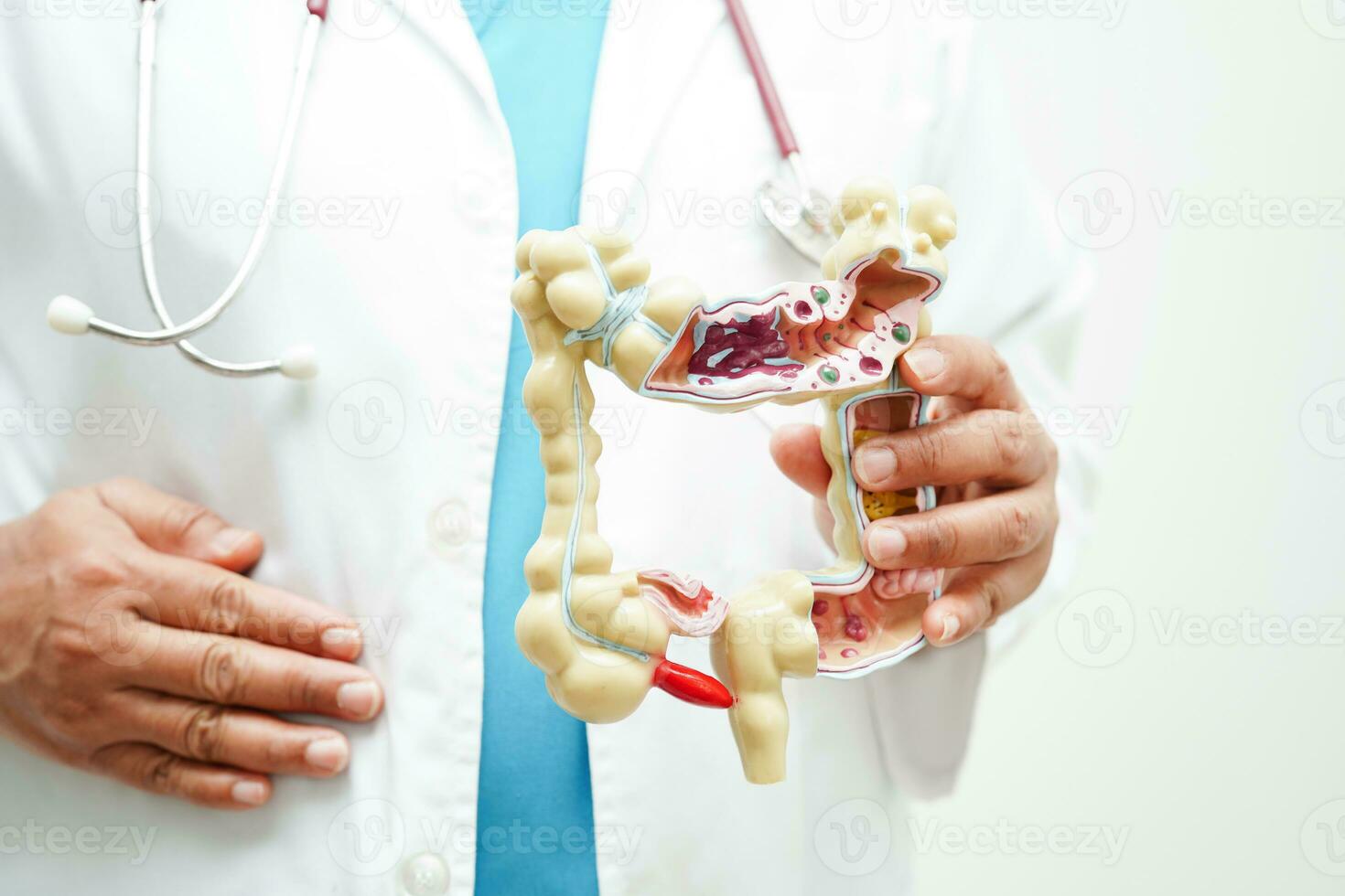 Stomach disease, doctor holding anatomy model for study diagnosis and treatment in hospital. photo
