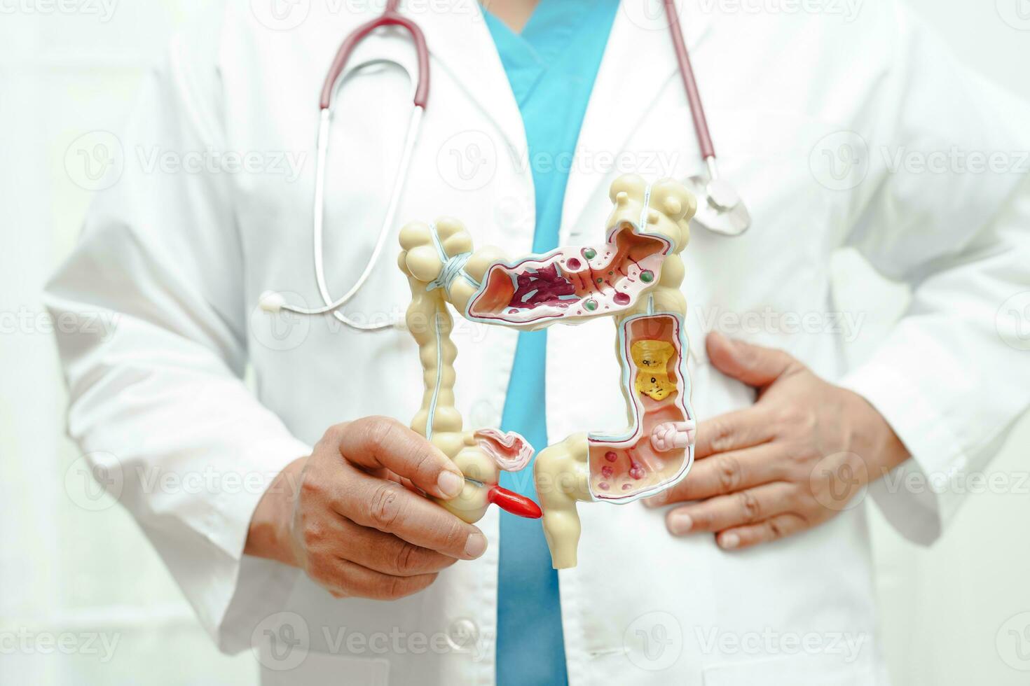 Intestine, doctor holding anatomy model for study diagnosis and treatment in hospital. photo