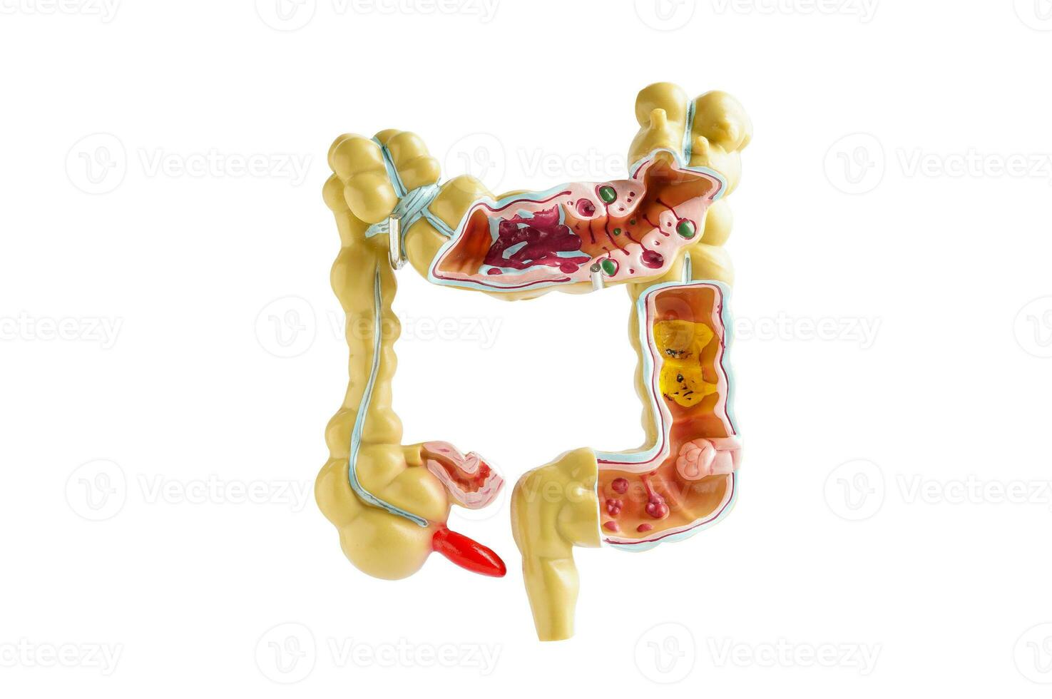 intestino modelo aislado en blanco antecedentes con recorte camino. , médico participación anatomía modelo para estudiar diagnóstico y tratamiento en hospital. foto