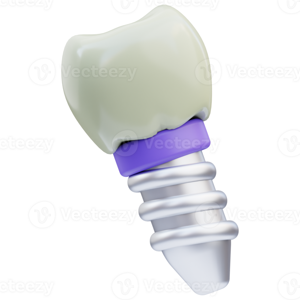 Dental Implant 3D Illustration png