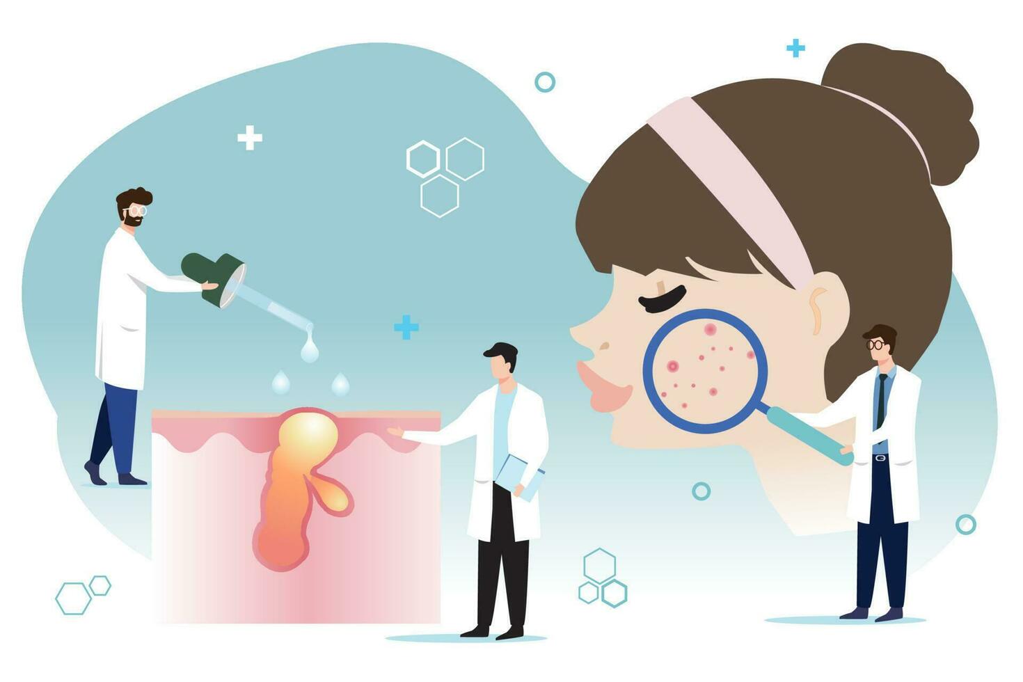 The dermatologists diagnose and treat woman skin vector on white background. The other one is holding magnifying glass, enlarged acne on skin and the other drop medicine on acne. Skin care concept.