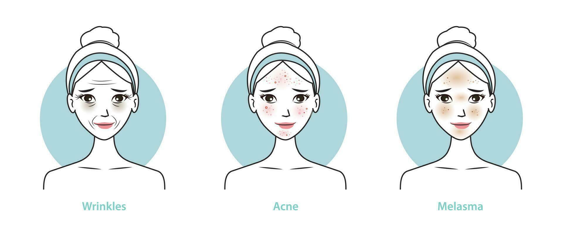 Skin problems set vector illustration isolated on white background. Infographic of cute woman with wrinkles, dark circles, acne, melasma and dark spots on face. Skin care and beauty concept.