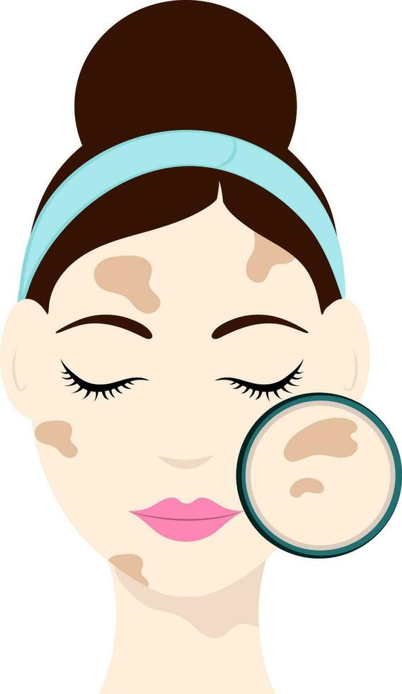 plano estilo inteligente niña con melasma en cara icono. vector