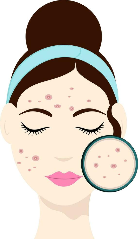 Flat Illustration Of Young Girl With Whiteheads On Face Icon. vector