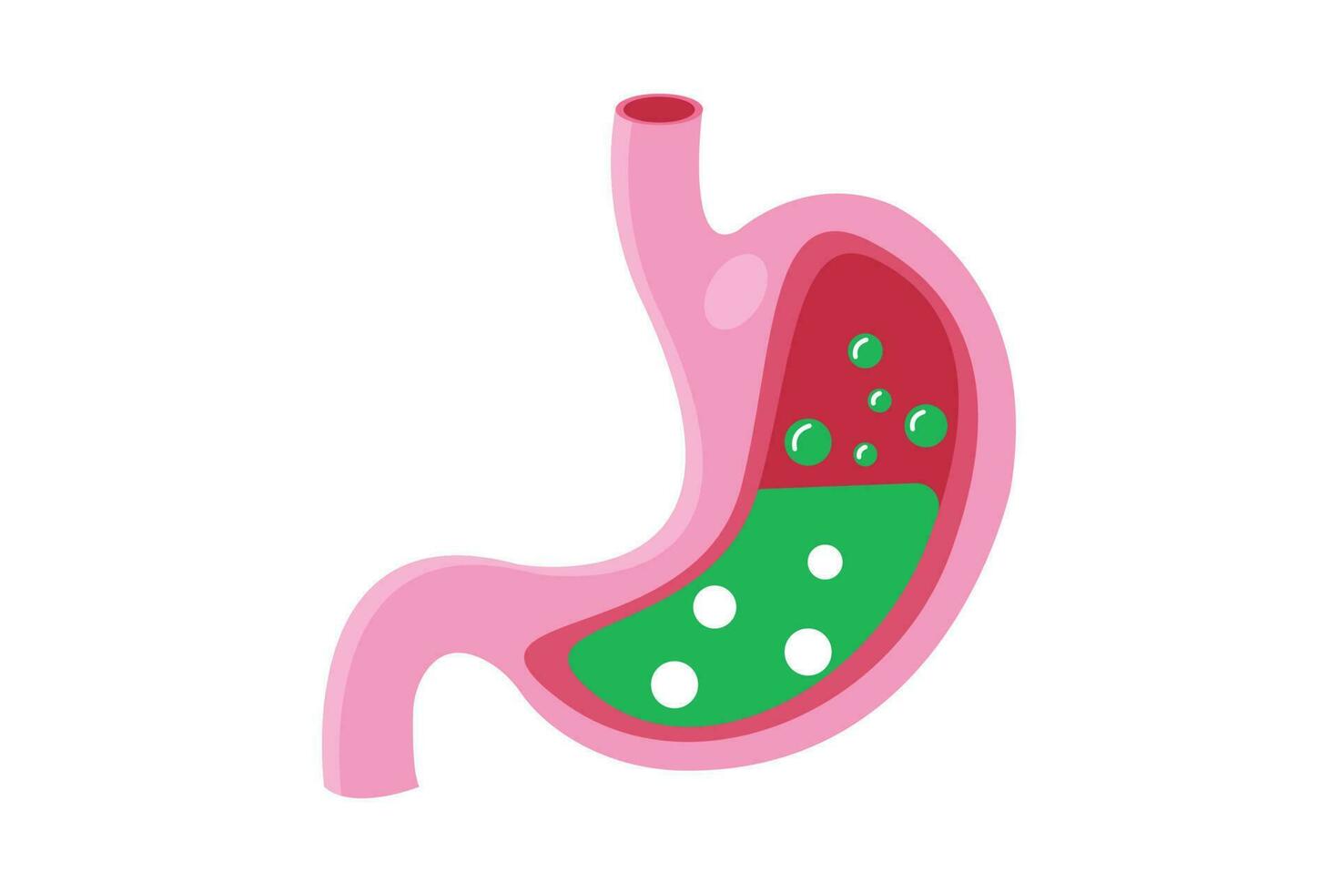 indigestion. medical illustration of nausea stomach isolated. Green liquid inside stomach. vector