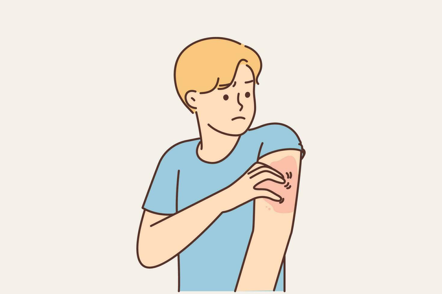 insalubre hombre rascarse brazo sufrir desde mono viruela. indispuesto chico picar mano dificil con dermatología problema. cuidado de la salud. vector ilustración.