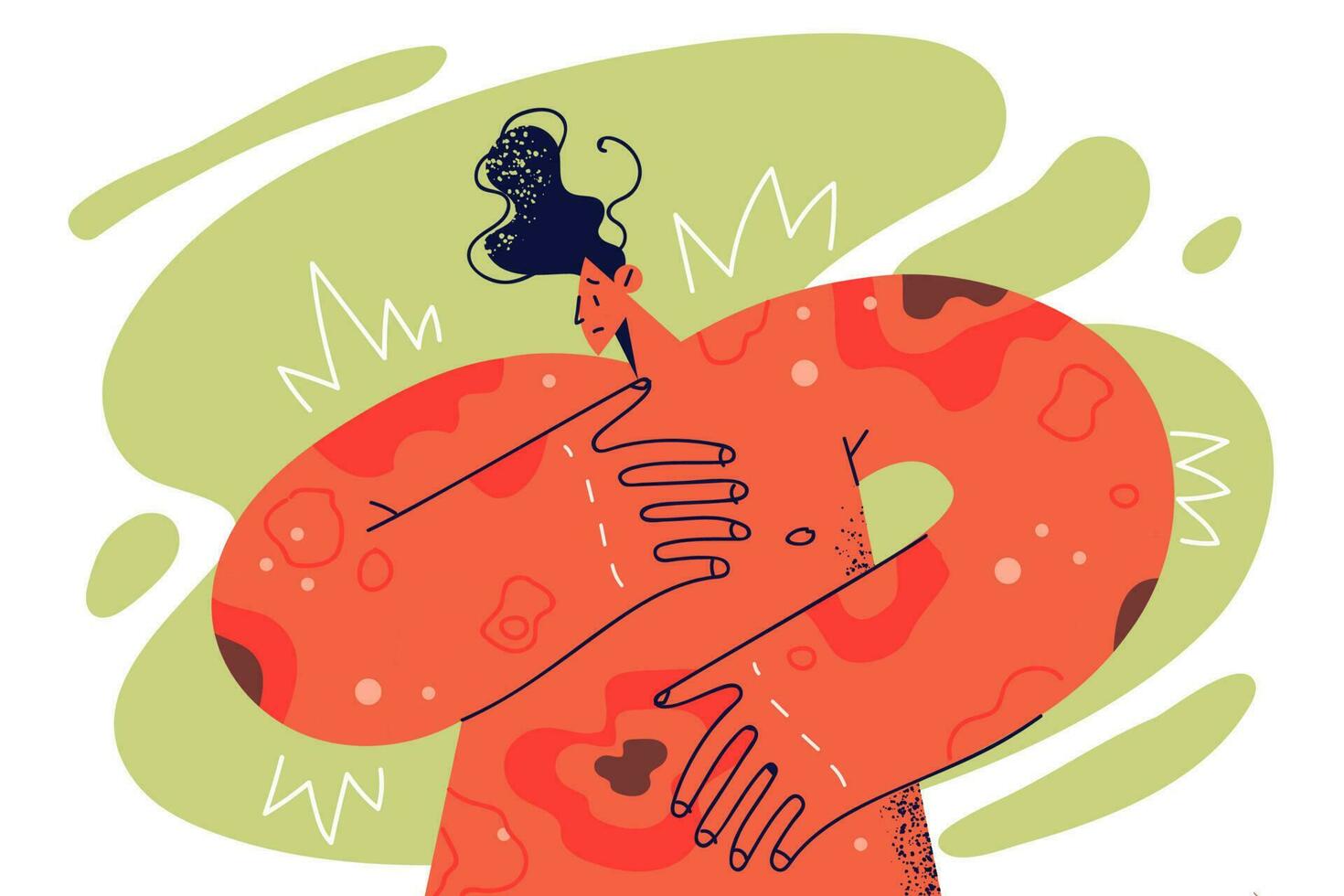 Unhappy sick man with red rash and spots on body. Unhealthy guy suffer from dermatology sickness or allergy. Dermatitis and healthcare. Vector illustration.