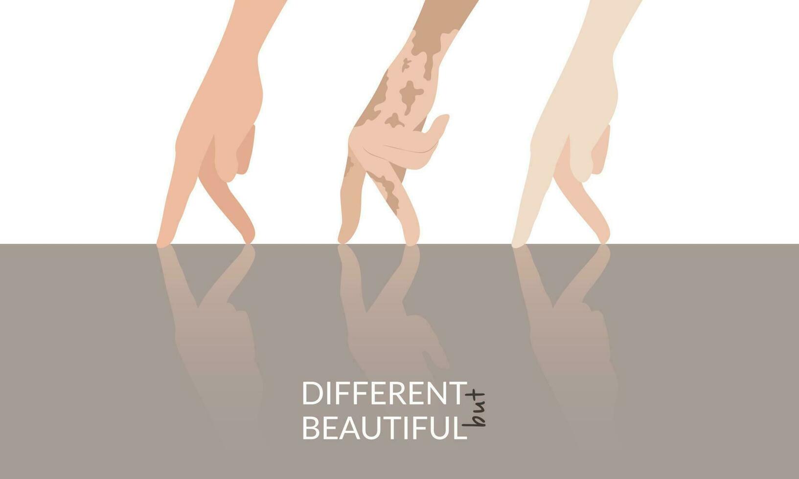 The hands of a normal, vitiligo, albino vector