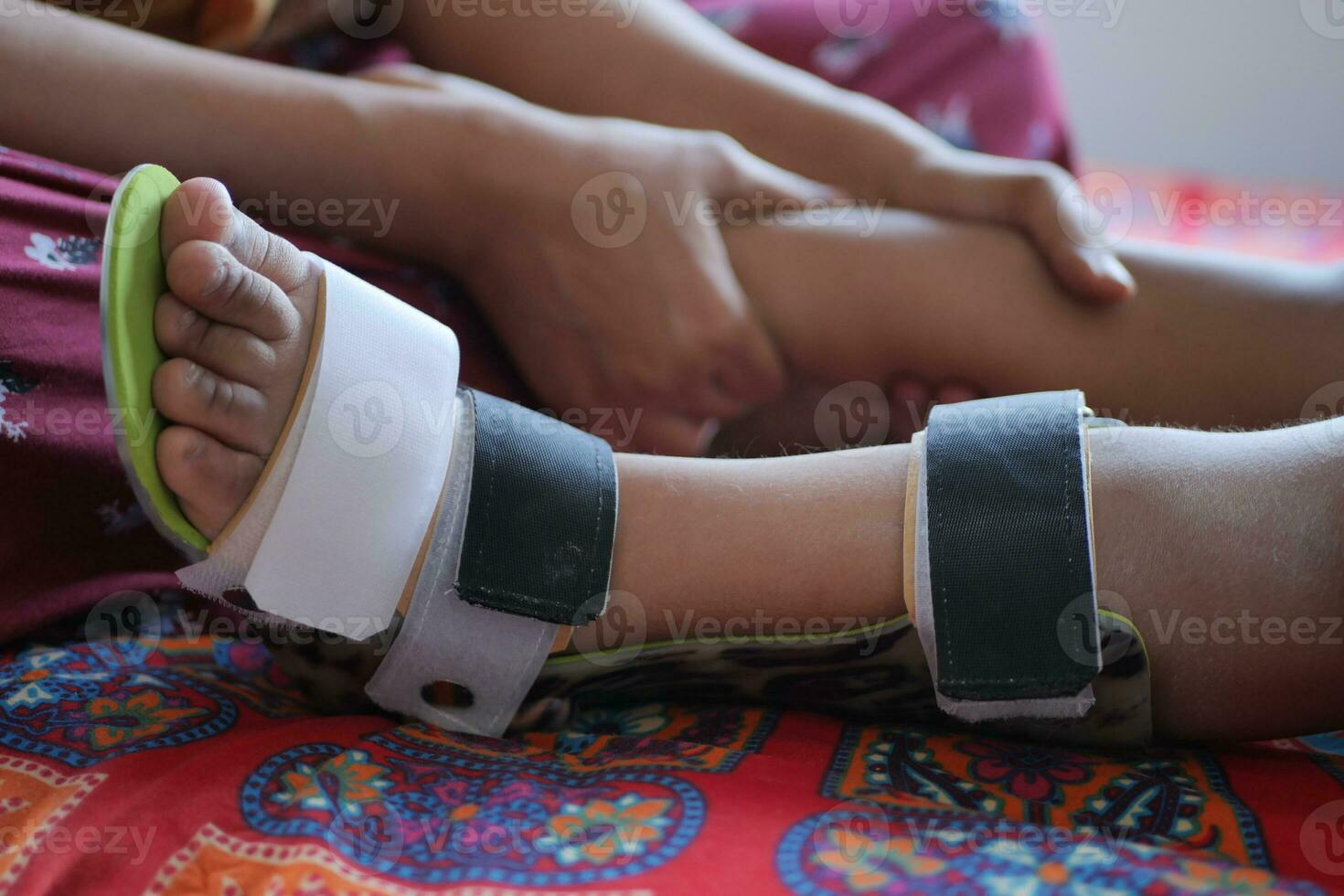 Child cerebral palsy disability, legs orthosis. photo