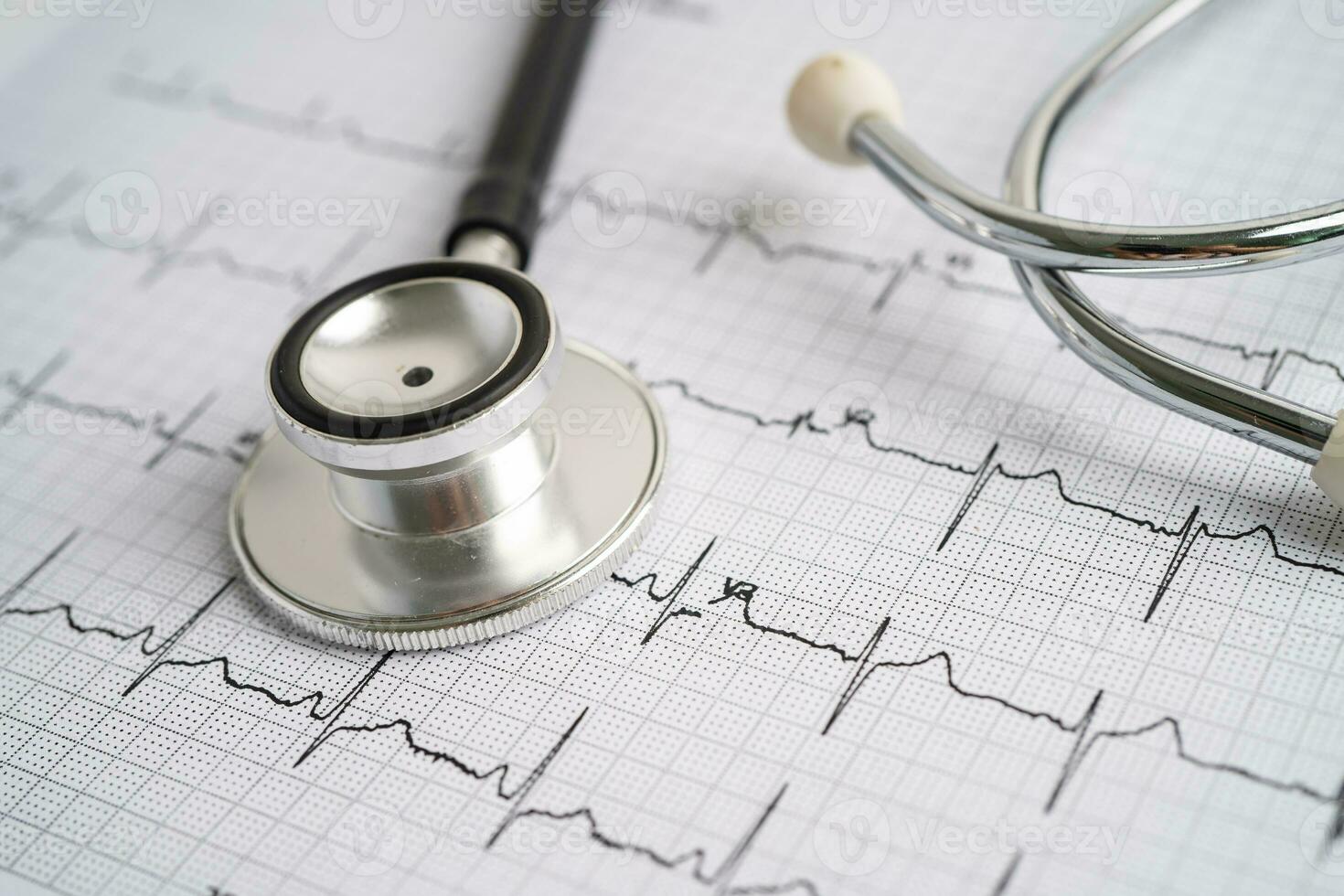 estetoscopio en electrocardiograma ecg, onda cardíaca, ataque cardíaco, informe de cardiograma. foto