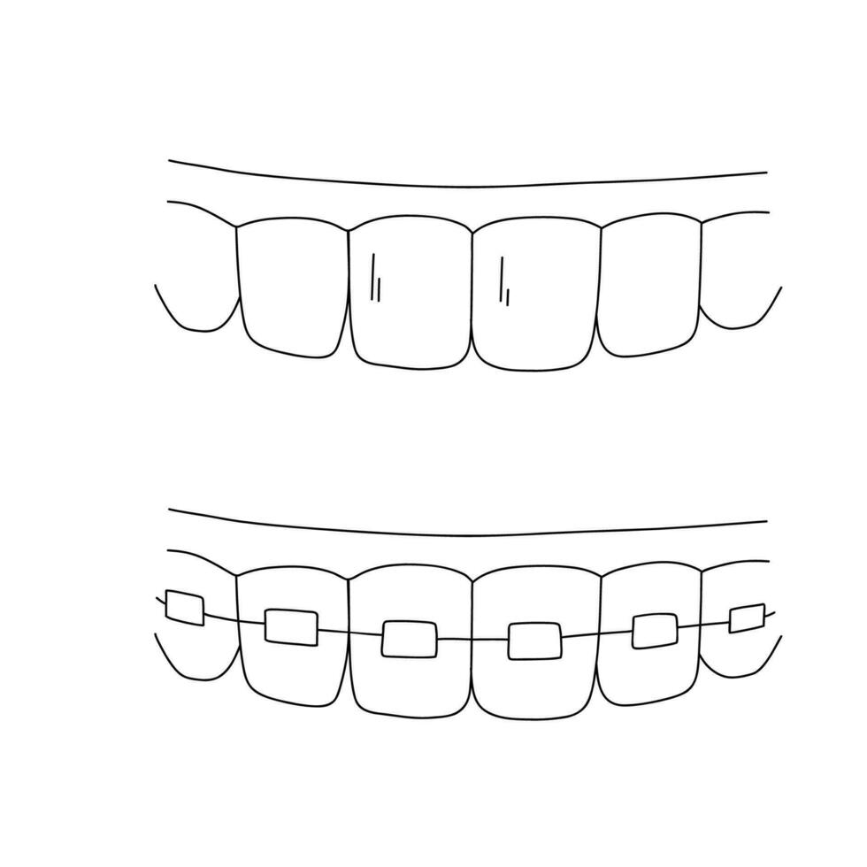 sano dientes bosquejo. diente tirantes contorno garabatear icono. odontología, estomatología y dental cuidado concepto. vector mano dibujado bosquejo aislado en blanco antecedentes.