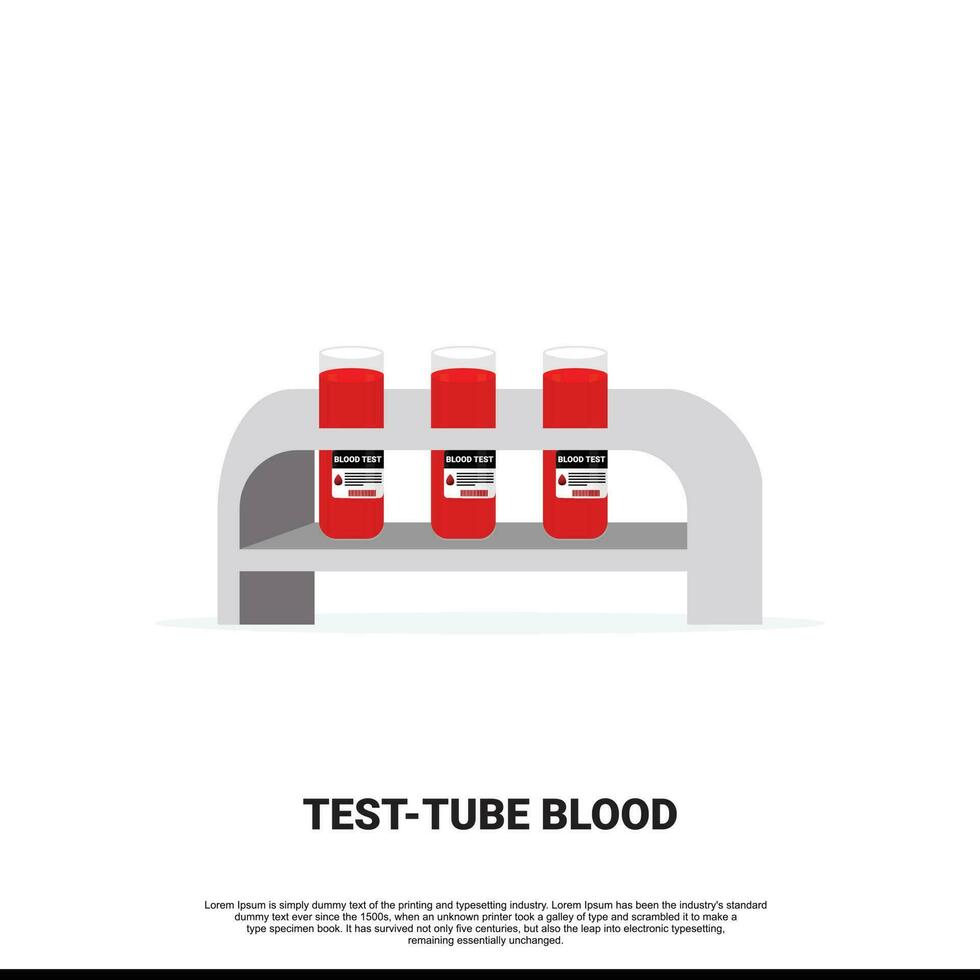 Médico Tubo De Ensayo Con Sangre Muestras, Aislado 24260364 Vector En ...