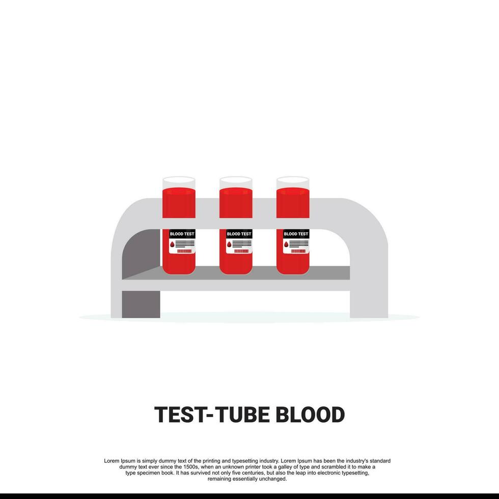 médico tubo de ensayo con sangre muestras, aislado vector