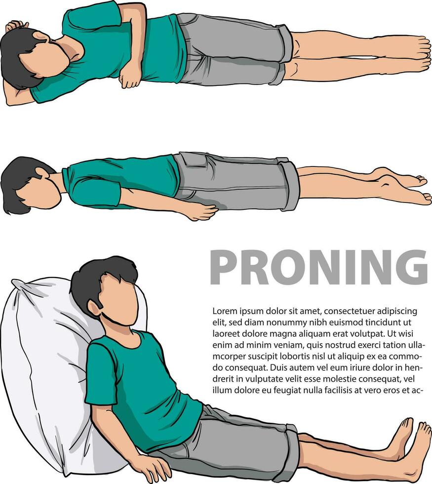 illustration of Proning or Prone positioning vector