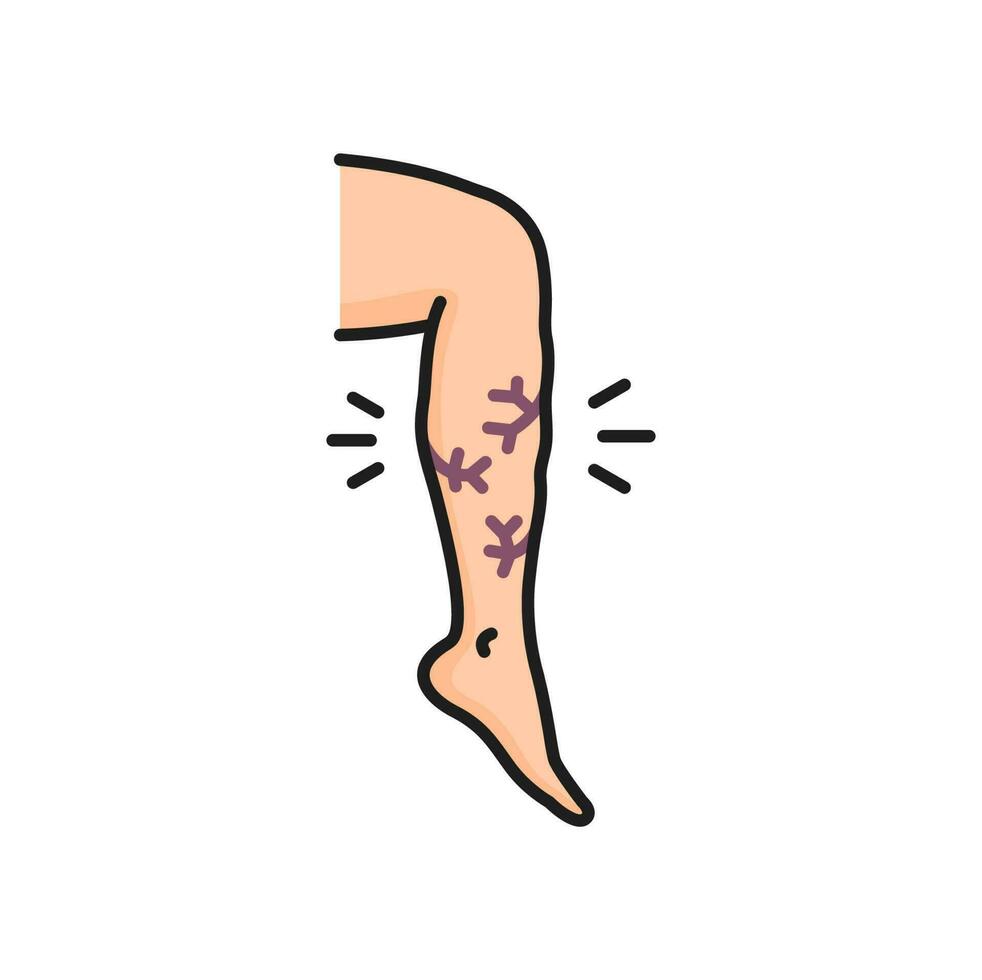 varicoso vena, venoso edema en pierna línea icono vector