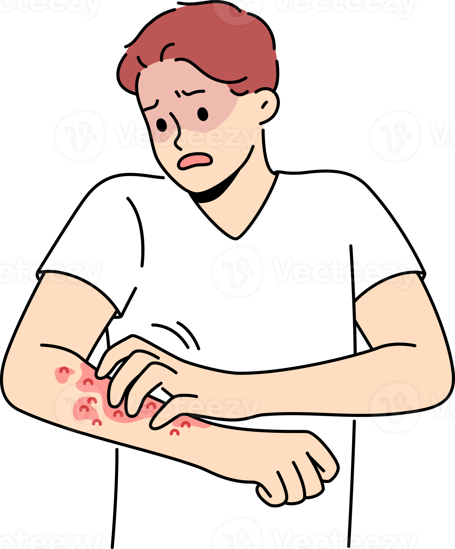 Unhealthy man scratch redness on arms 24501409 PNG