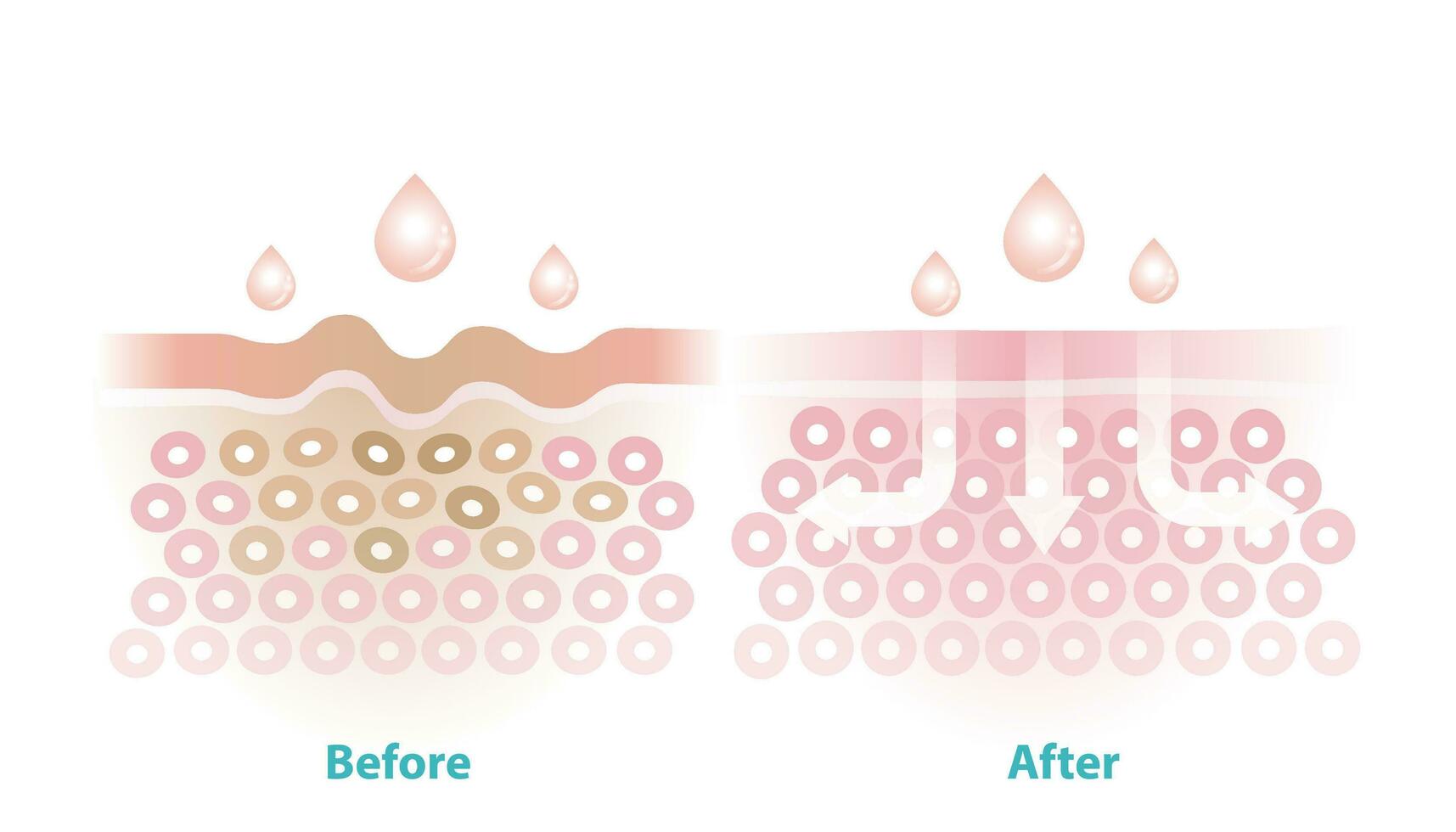 Before and after skincare reduce wrinkles vector illustration isolated on white background. Cross section of wrinkles skin and skincare absorbing to help reduce aging and damaged skin.