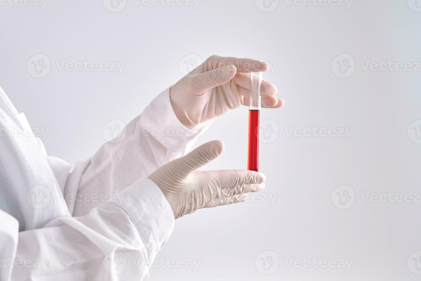 Test tube with blood in the hand. photo